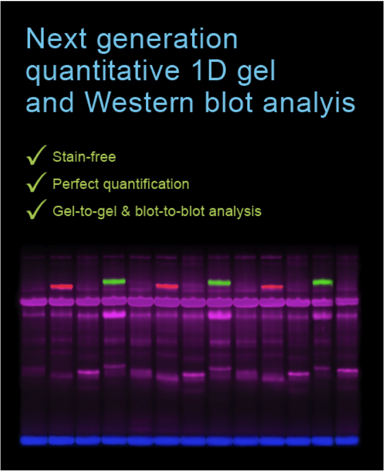 Figure Smart Protein Labeling for quantitative 1D gels and Western blots